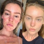 سرم زغال گارنیر - تصویر 3