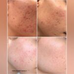 سرم زغال گارنیر - تصویر 2